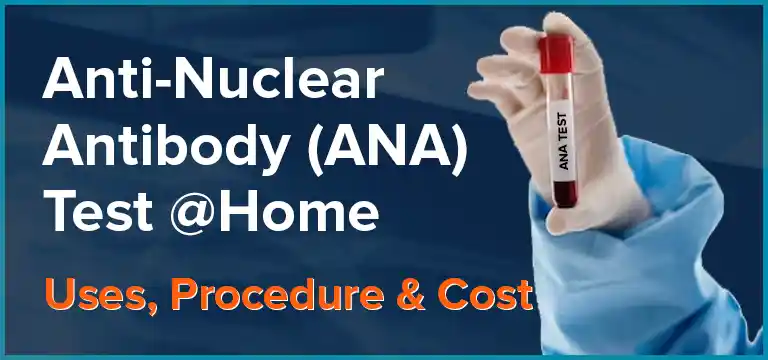 Anti-Nuclear Antibody (ANA) Test at Home - Uses, Procedure & Cost